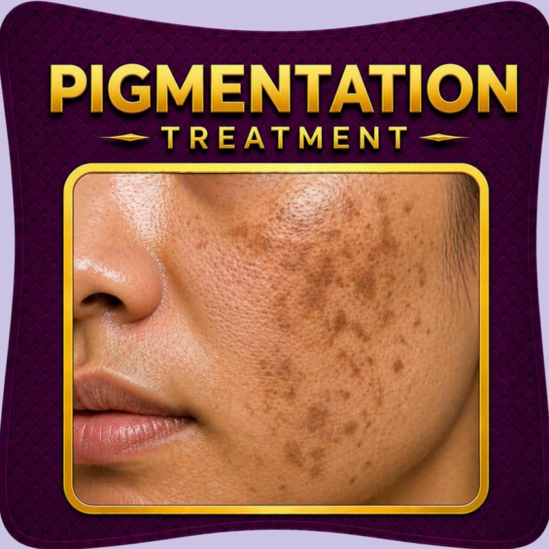 Pigmentation treatment uneven skin tone solution