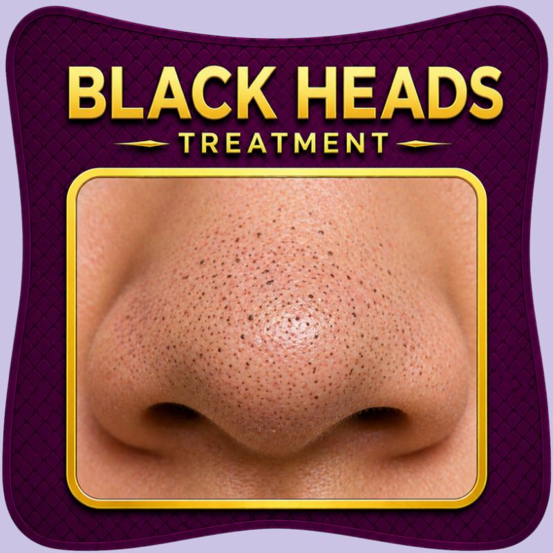 Blackhead removal deep cleansing skincare