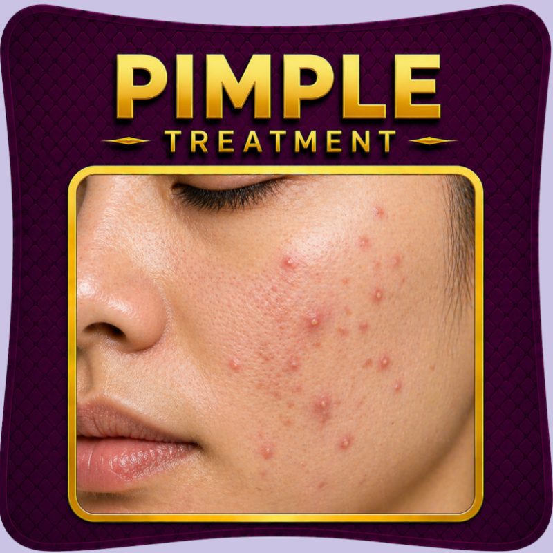 Pimple treatment fast acne spot care solution
