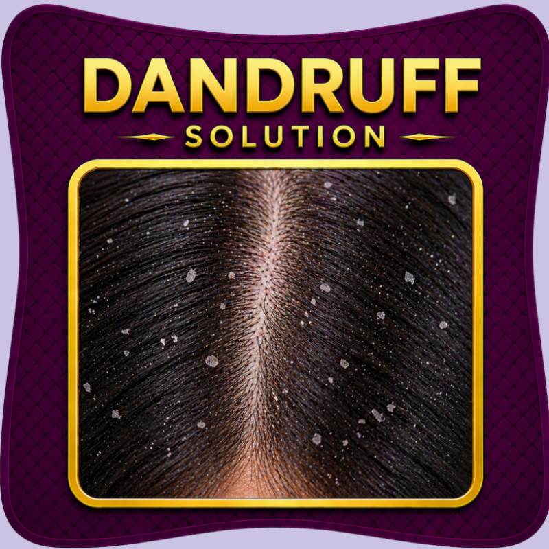 Dandruff treatment scalp care anti dandruff solution